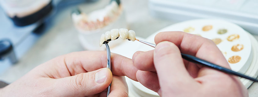 frontzähne dentaltechnische leistungen